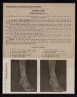 Lower Limb. Dorsum of Foot - no. 2